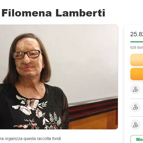 A Salerno una raccolta fondi per aiutare Filomena Lamberti, sfregiata con l’acido nel 2012