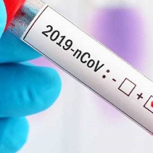 Covid, a Scafati virus non ancora debellato: ricoverati 3 asintomatici 