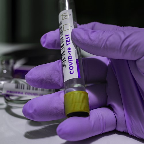 Covid, ad Eboli e Roccapiemonte i guariti giornalieri superano i nuovi positivi: dati e bollettini 