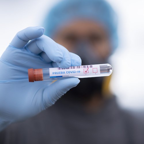 Covid, ospedali di Salerno ed Eboli in affanno: oltre 4000 tamponi nel fine settimana
